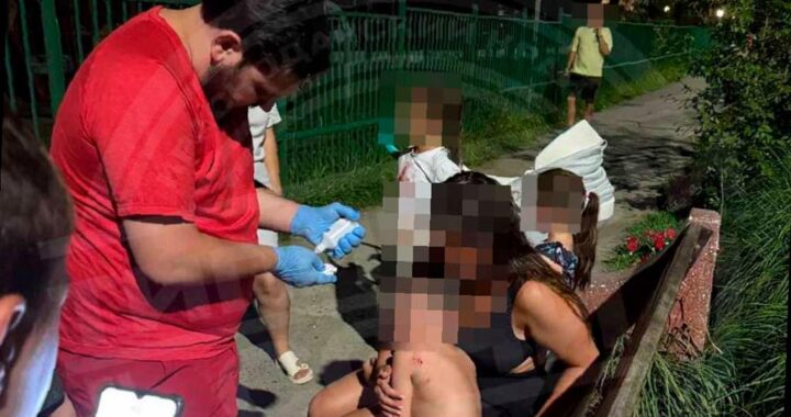 В Сочи на детской площадке собака напала на ребенка